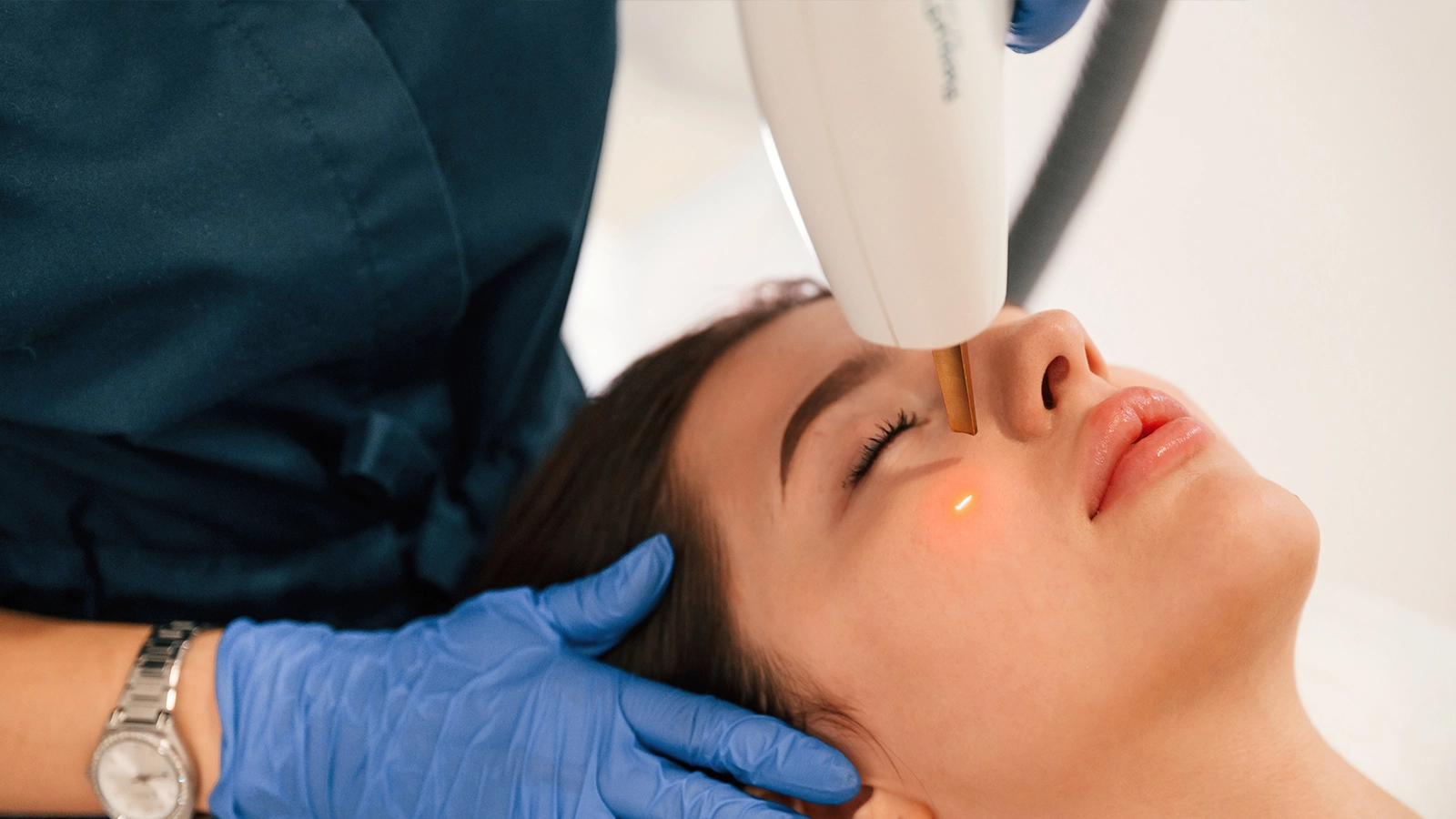 BBL Laser Benefits for Skin